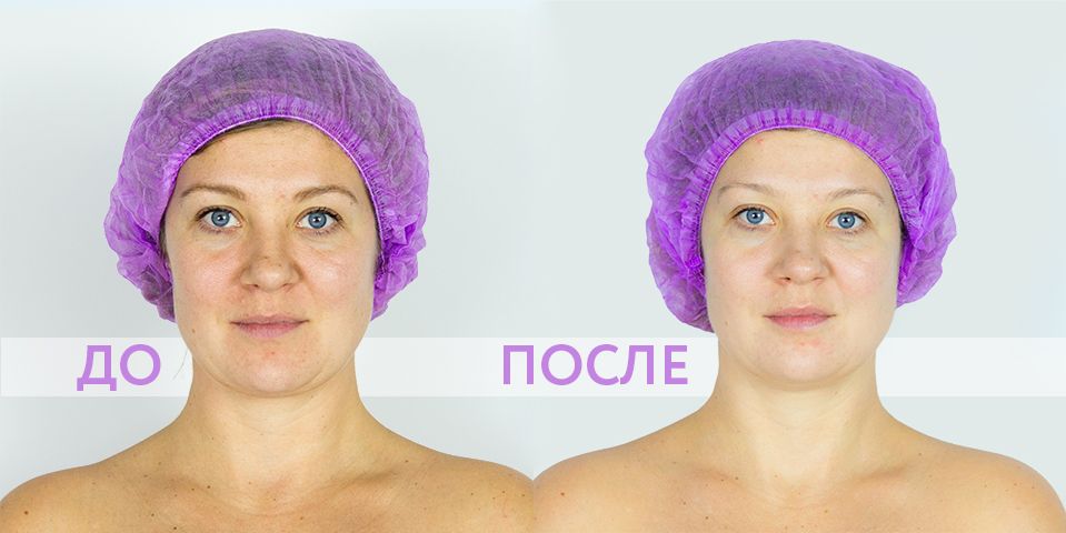 До_после.jpg До_после.jpg